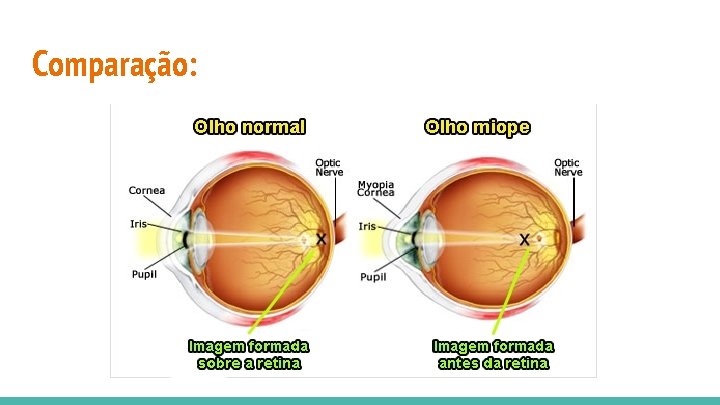 Comparação: 