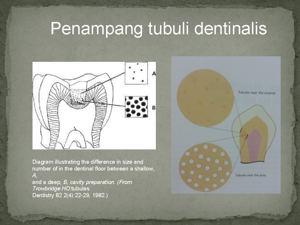 Penampang tubuli dentinalis Diagram illustrating the difference in size and number of in the