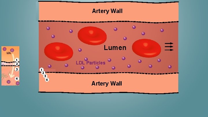 Artery Wall Lumen 1 2 3 4 LDL Particles 1 2 3 4 Artery