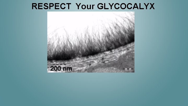 RESPECT Your GLYCOCALYX 