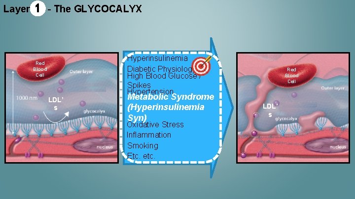 Layer 1 - The GLYCOCALYX Red Blood Cell LDL’ s Hyperinsulinemia Diabetic Physiology High