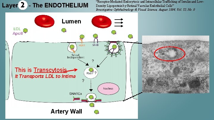 Layer 2 - The ENDOTHELIUM Lumen This is Transcytosis It Transports LDL to Intima