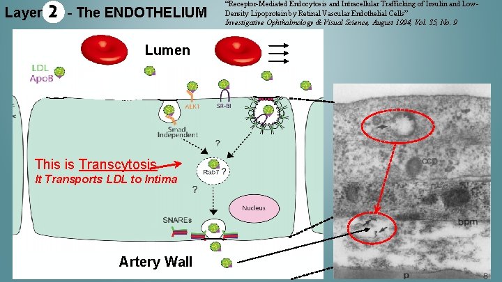 Layer 2 - The ENDOTHELIUM Lumen This is Transcytosis It Transports LDL to Intima