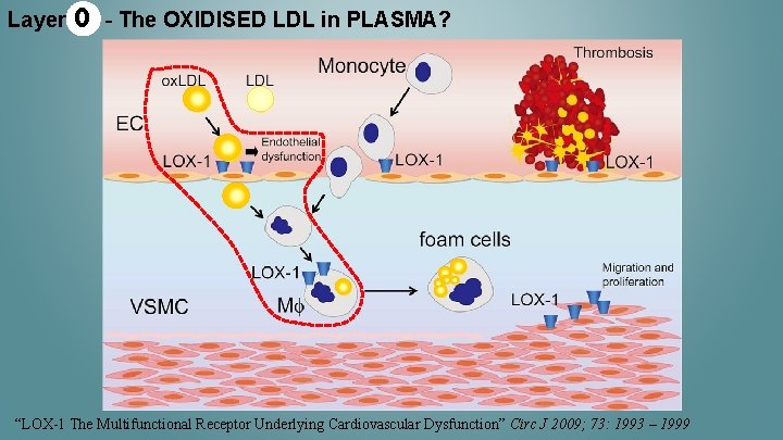 Layer 0 - The OXIDISED LDL in PLASMA? “LOX-1 The Multifunctional Receptor Underlying Cardiovascular