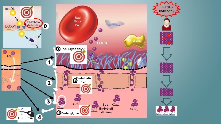 Hi-LDLp Unhealthy Red Blood Cell 0 LDL’s 1 The Glycocalyx 1 2 2 Endothelial