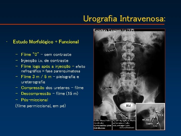 Urografia Intravenosa: • Estudo Morfológico + Funcional – Filme “ 0” – sem contraste