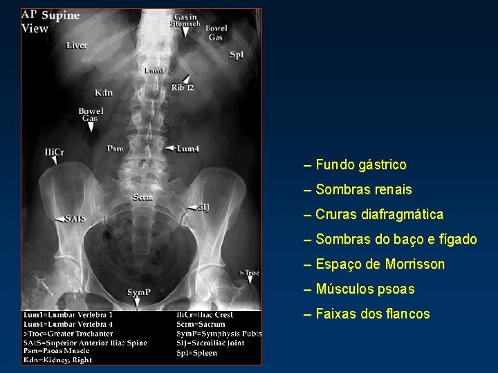 – Fundo gástrico – Sombras renais – Cruras diafragmática – Sombras do baço e