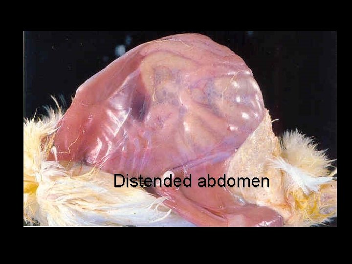 Distended abdomen 