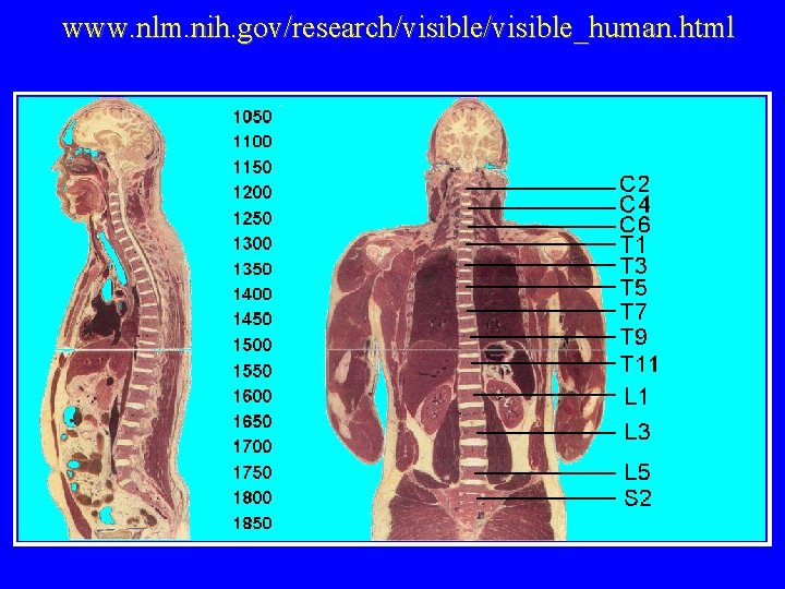 www. nlm. nih. gov/research/visible_human. html 