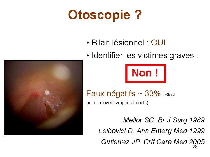 Otoscopie ? • Bilan lésionnel : OUI • Identifier les victimes graves : Non