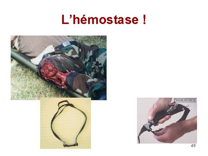 L’hémostase ! 49 