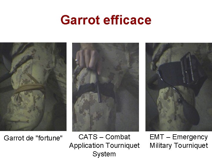 Garrot efficace Garrot de "fortune" CATS – Combat Application Tourniquet System EMT – Emergency