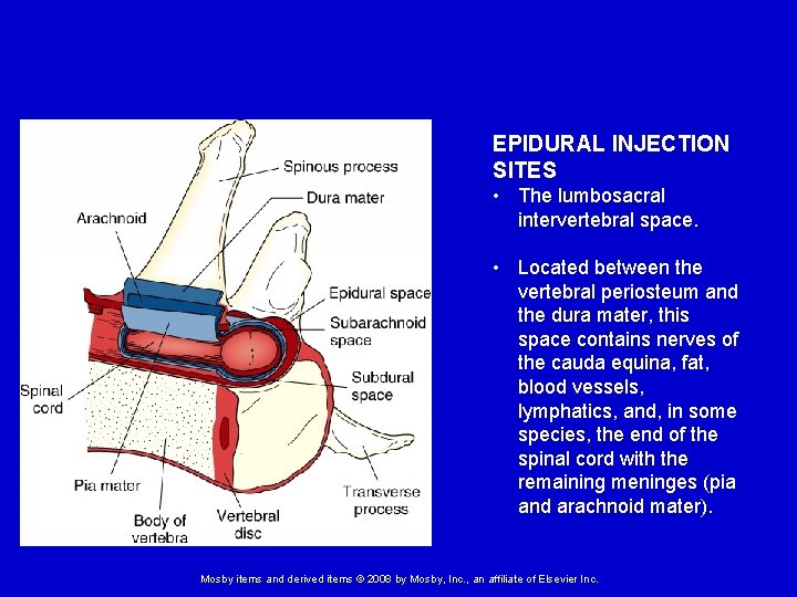 EPIDURAL INJECTION SITES • The lumbosacral intervertebral space. • Located between the vertebral periosteum
