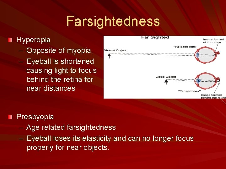 Farsightedness Hyperopia – Opposite of myopia. – Eyeball is shortened causing light to focus