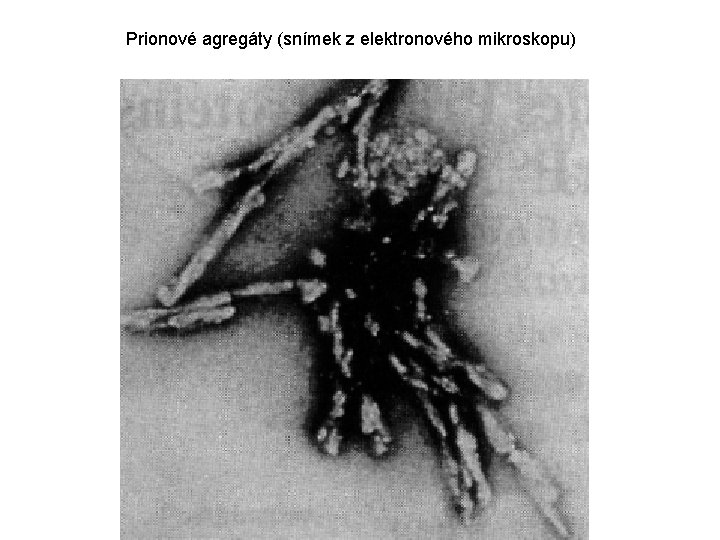 Prionové agregáty (snímek z elektronového mikroskopu) 