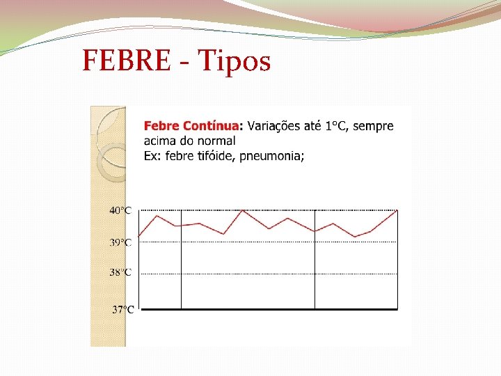 FEBRE - Tipos 
