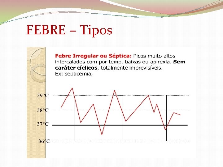  FEBRE – Tipos 