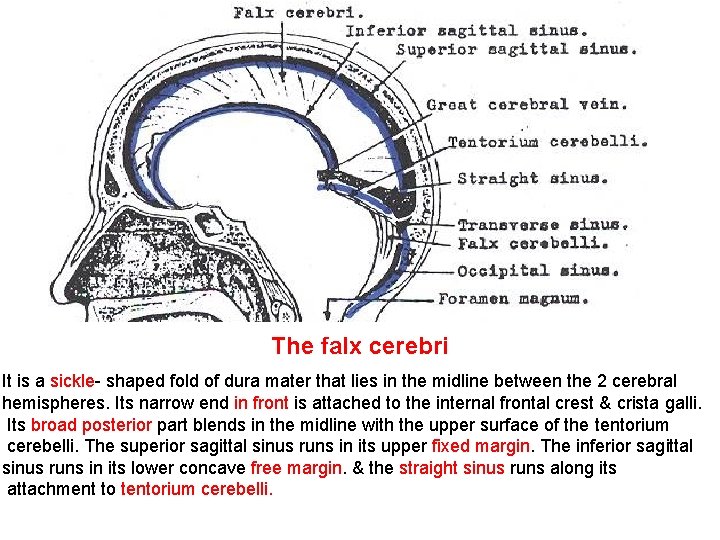 The falx cerebri It is a sickle- shaped fold of dura mater that lies