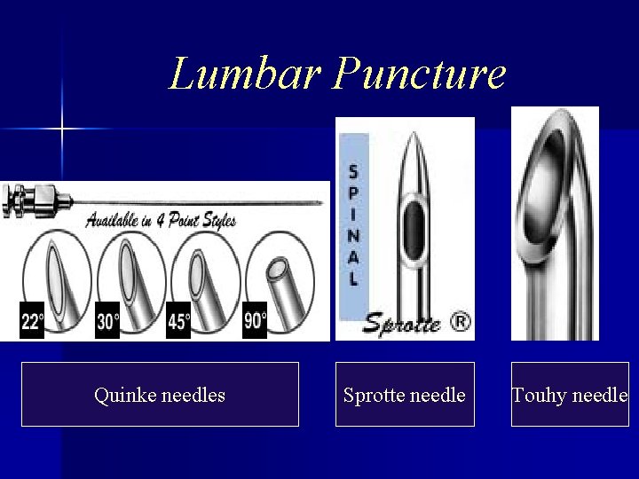 Lumbar Puncture Quinke needles Sprotte needle Touhy needle 