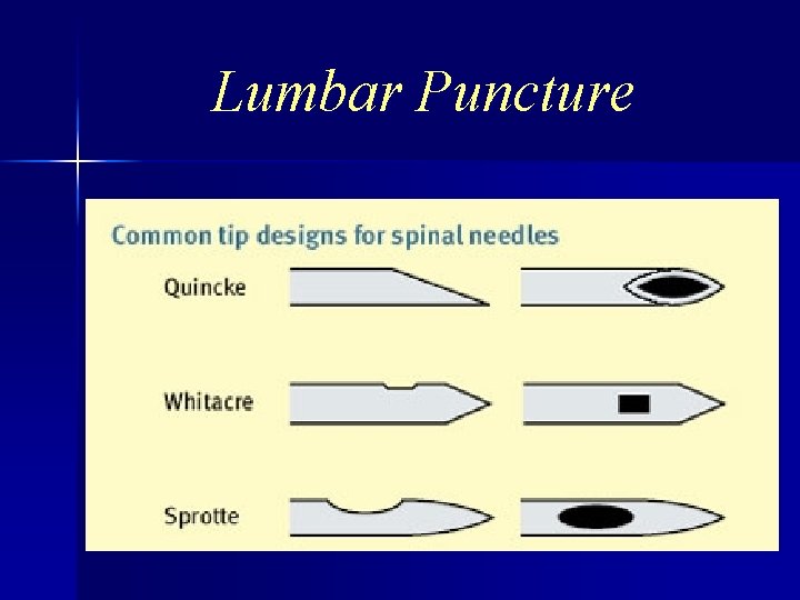 Lumbar Puncture 