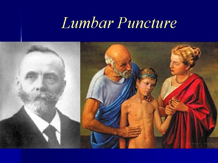 Lumbar Puncture 