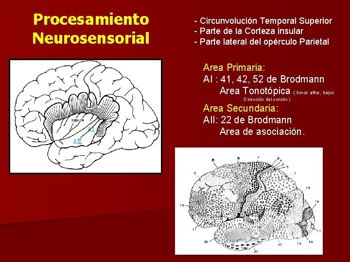 Procesamiento Neurosensorial - Circunvolución Temporal Superior - Parte de la Corteza insular - Parte