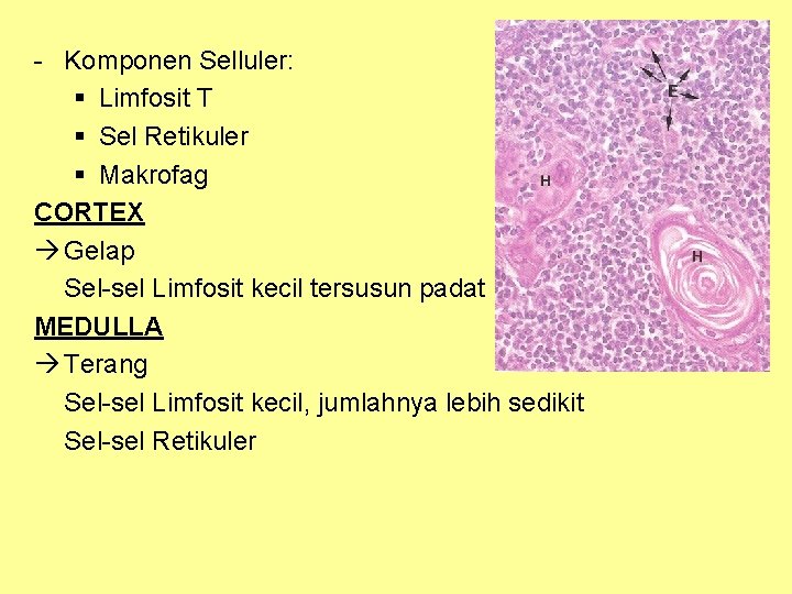 - Komponen Selluler: § Limfosit T § Sel Retikuler § Makrofag CORTEX Gelap Sel-sel