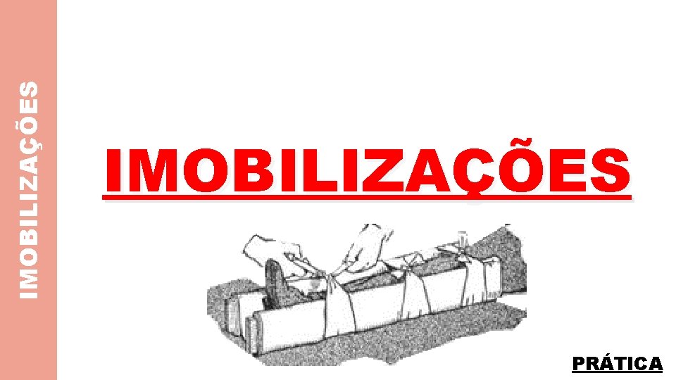 IMOBILIZAÇÕES PRÁTICA 