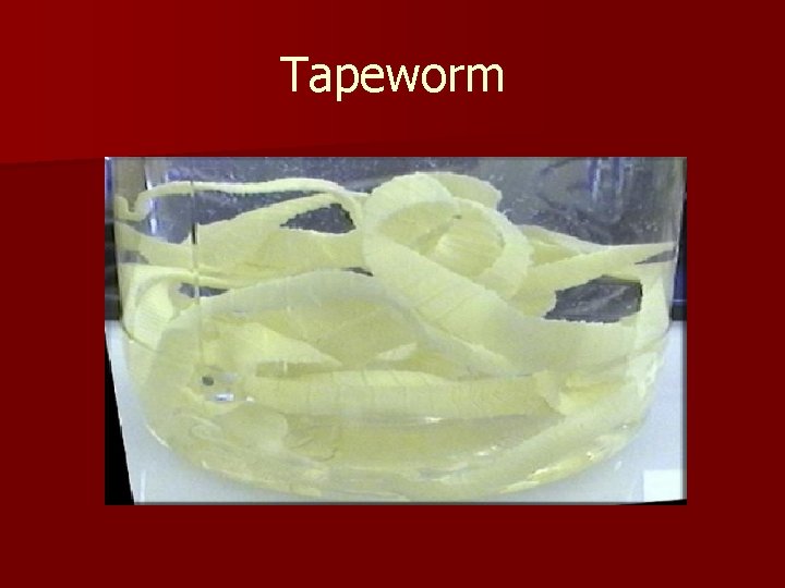 Tapeworm 