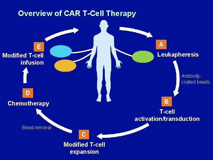 Overview of CAR T-Cell Therapy A E Modified T-cell infusion Leukapheresis Antibodycoated beads D