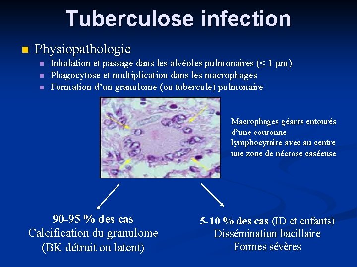 Tuberculose infection Physiopathologie Inhalation et passage dans les alvéoles pulmonaires (≤ 1 µm) Phagocytose