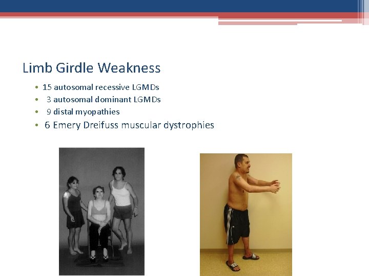 Limb Girdle Weakness • 15 autosomal recessive LGMDs • 3 autosomal dominant LGMDs •