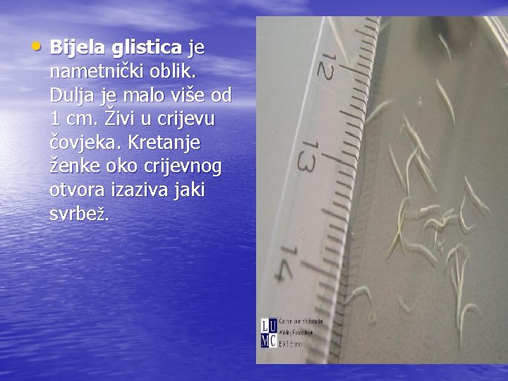  • Bijela glistica je nametnički oblik. Dulja je malo više od 1 cm.