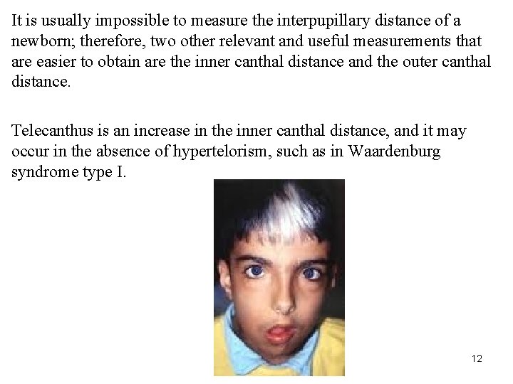 It is usually impossible to measure the interpupillary distance of a newborn; therefore, two