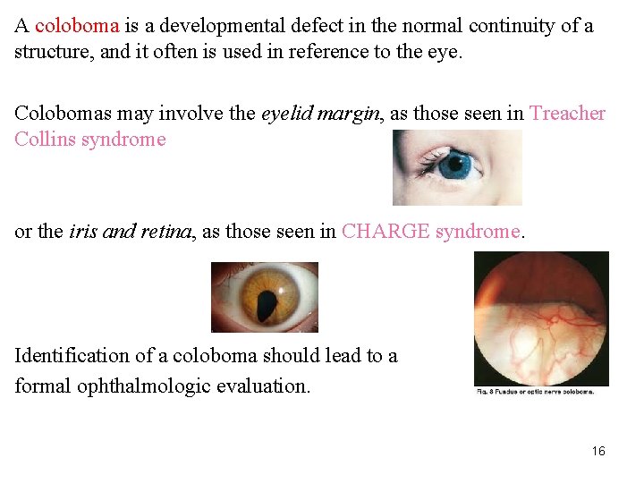 A coloboma is a developmental defect in the normal continuity of a structure, and