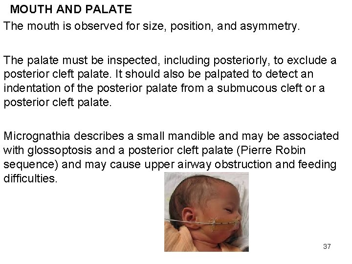 MOUTH AND PALATE The mouth is observed for size, position, and asymmetry. The palate