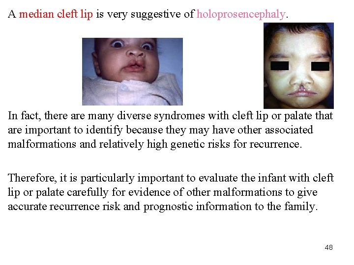 A median cleft lip is very suggestive of holoprosencephaly. In fact, there are many