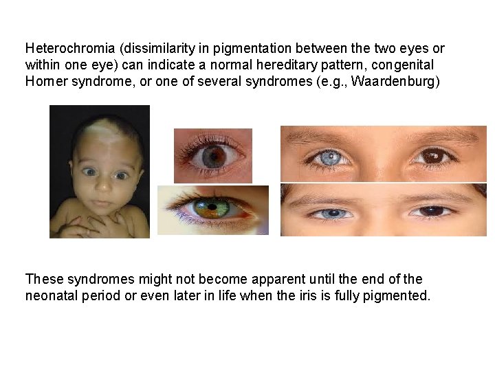 Heterochromia (dissimilarity in pigmentation between the two eyes or within one eye) can indicate