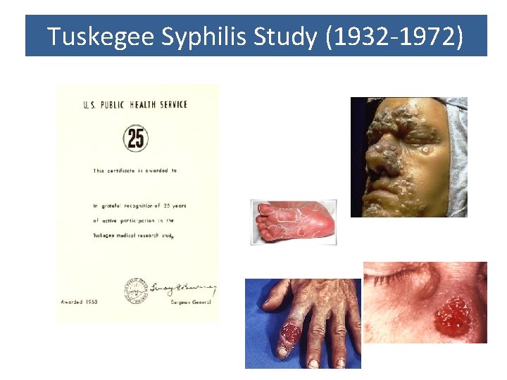 Tuskegee Syphilis Study (1932 -1972) 
