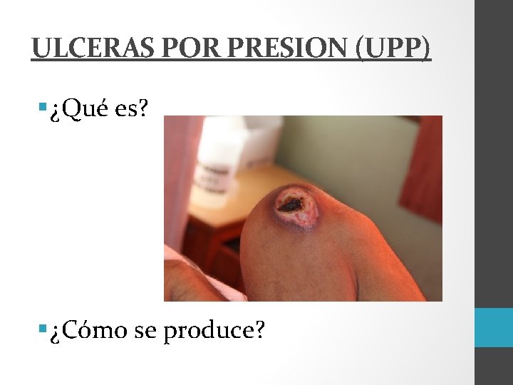 ULCERAS POR PRESION (UPP) § ¿Qué es? § ¿Cómo se produce? 