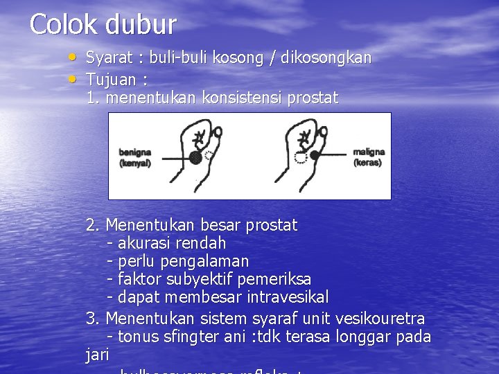 Colok dubur • Syarat : buli-buli kosong / dikosongkan • Tujuan : 1. menentukan