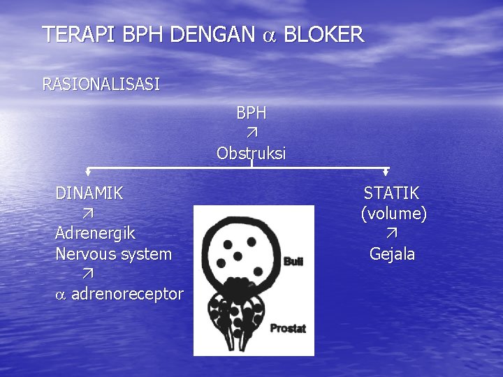 TERAPI BPH DENGAN BLOKER RASIONALISASI BPH Obstruksi DINAMIK Adrenergik Nervous system adrenoreceptor STATIK (volume)
