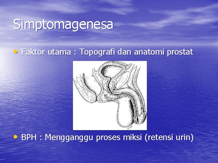 Simptomagenesa • Faktor utama : Topografi dan anatomi prostat • BPH : Mengganggu proses