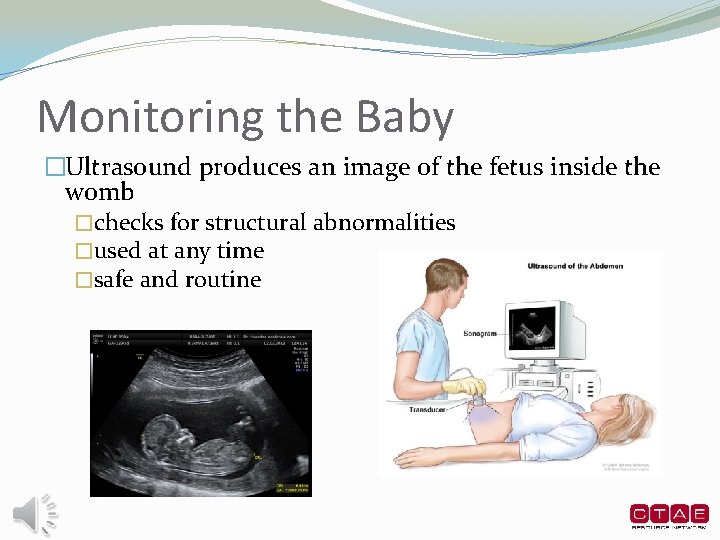 Monitoring the Baby �Ultrasound produces an image of the fetus inside the womb �checks