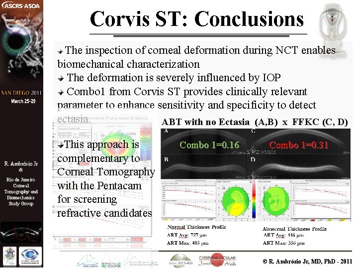 Corvis ST: Conclusions The inspection of corneal deformation during NCT enables biomechanical characterization The