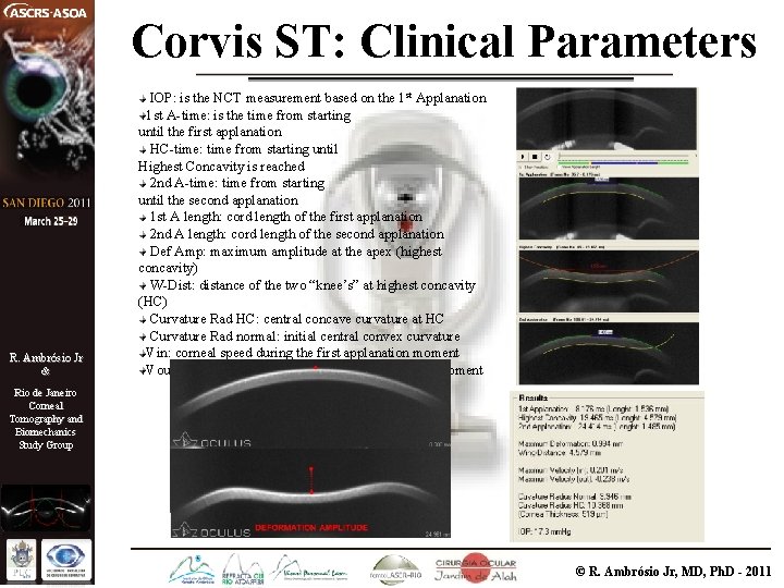 Corvis ST: Clinical Parameters R. Ambrósio Jr & IOP: is the NCT measurement based
