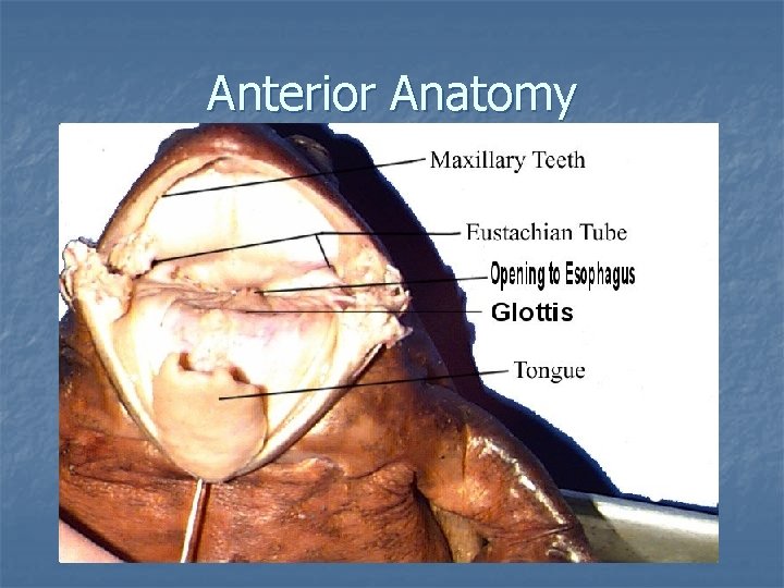 Anterior Anatomy 