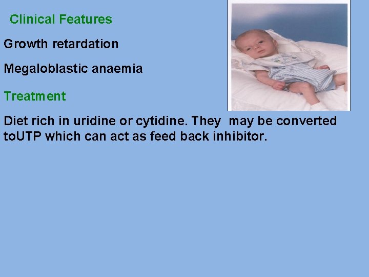 Clinical Features Growth retardation Megaloblastic anaemia Treatment Diet rich in uridine or cytidine. They