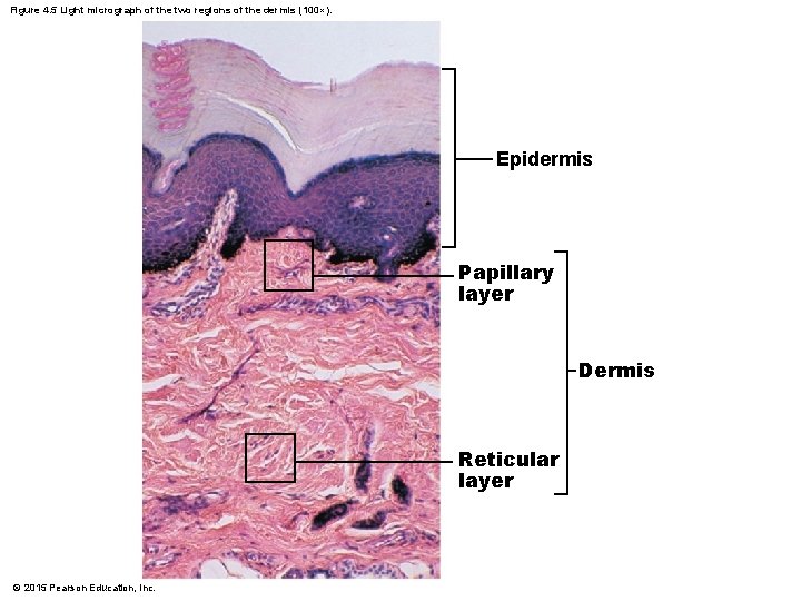 Figure 4. 5 Light micrograph of the two regions of the dermis (100×). Epidermis