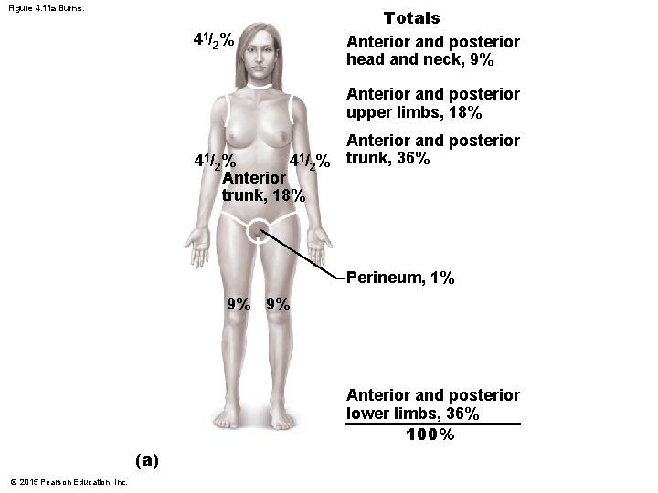 Figure 4. 11 a Burns. Totals Anterior and posterior head and neck, 9% 41